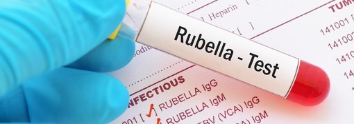 בדיקת נוגדנים לאדמת - Rubella Antibodies- IgG - תמונה
